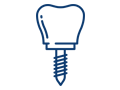 Dental Implant Procedures
